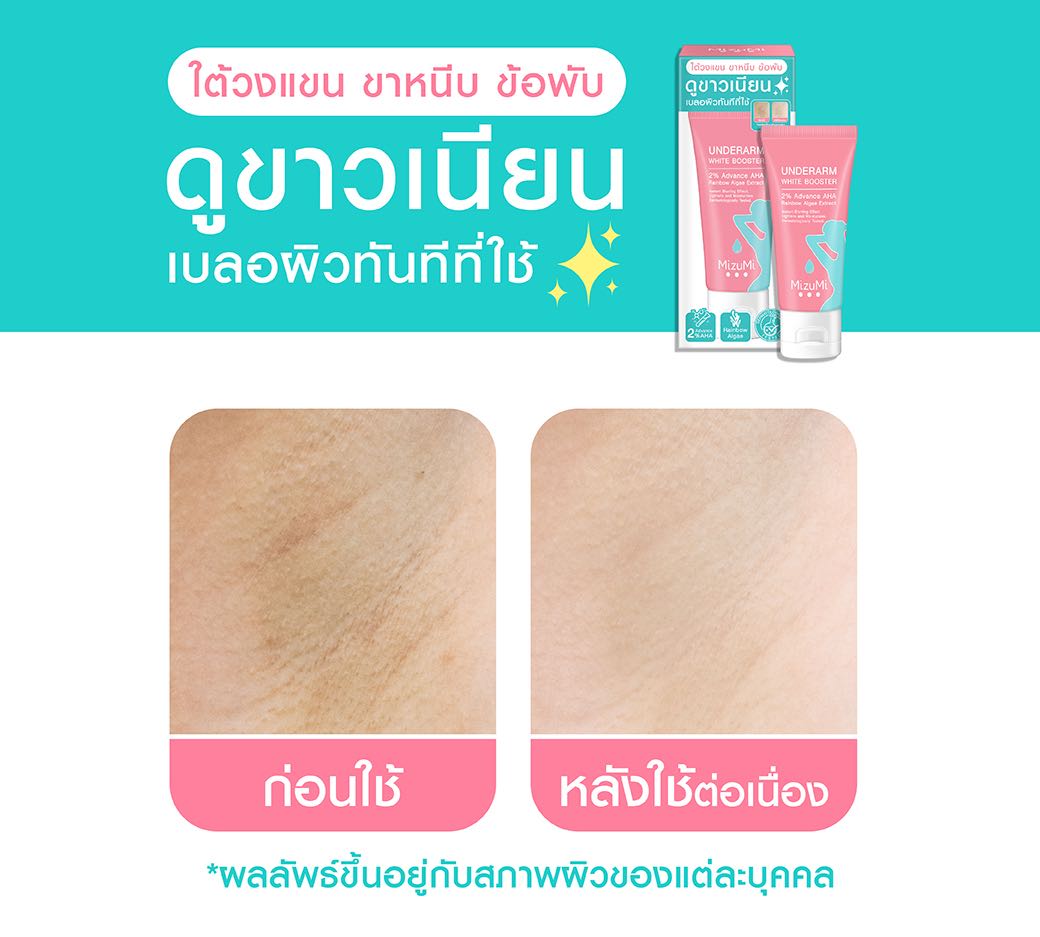 Mizumi Underarm White Booster 30 g.