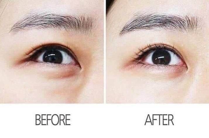 AHC Premier Ampoule Eye Cream for Face Line Tightening 40 ml.