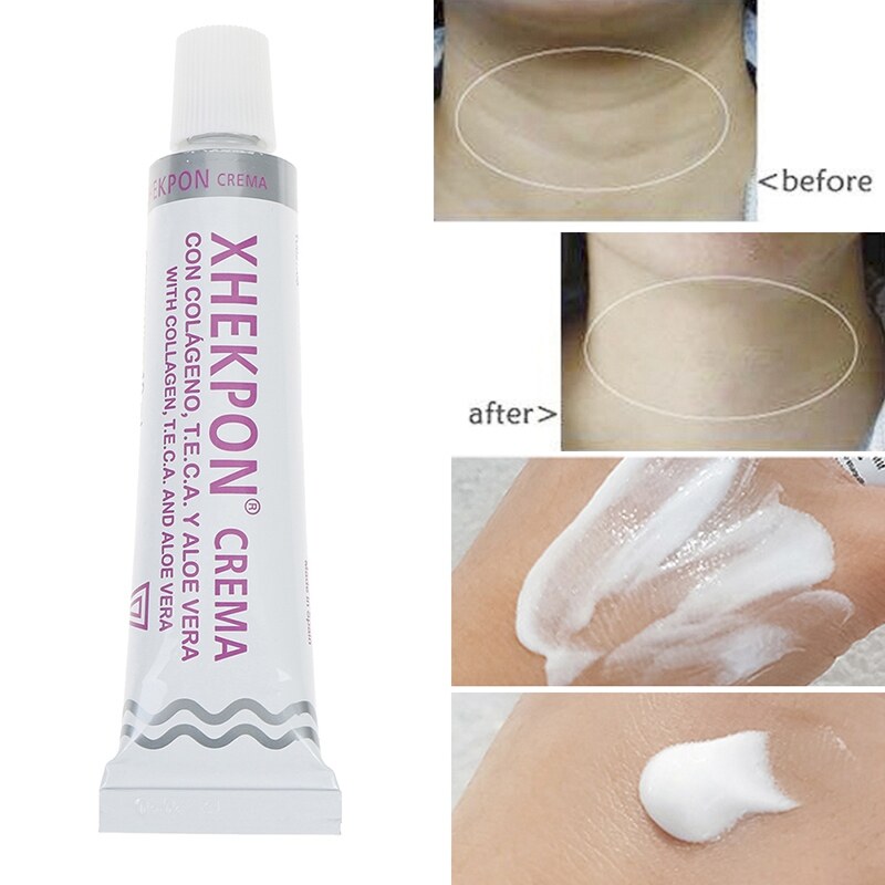 Xhekpon Cream 40 ml.