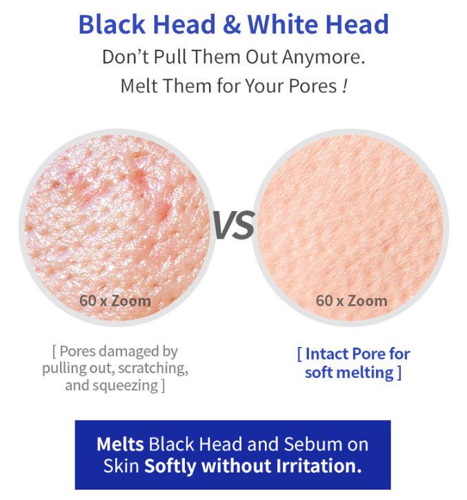 One Day's You P.Z SSOC SSOC No More Blackhead Pore Clearing 100 ml.