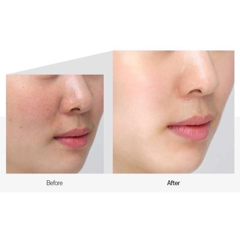 MEDI-PEEL Bio-Intense 600 Glutathione White Cream 50 ml.