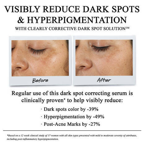 Kiehl's Clearly Corrective Dark Spot Solution 30 ml.