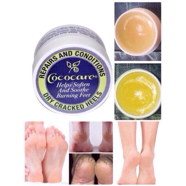Cococare Repairs and Conditions Dry Cracked Heels 11 g.