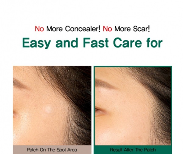 SOME BY MI 30 Days Miracle Clear Spot Patch 18 ชิ้น