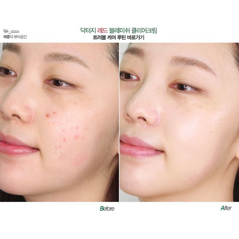 Dr.G R.E.D Blemish Clear Soothing Cream 70 ml. X Inside Out 2 Set X 2