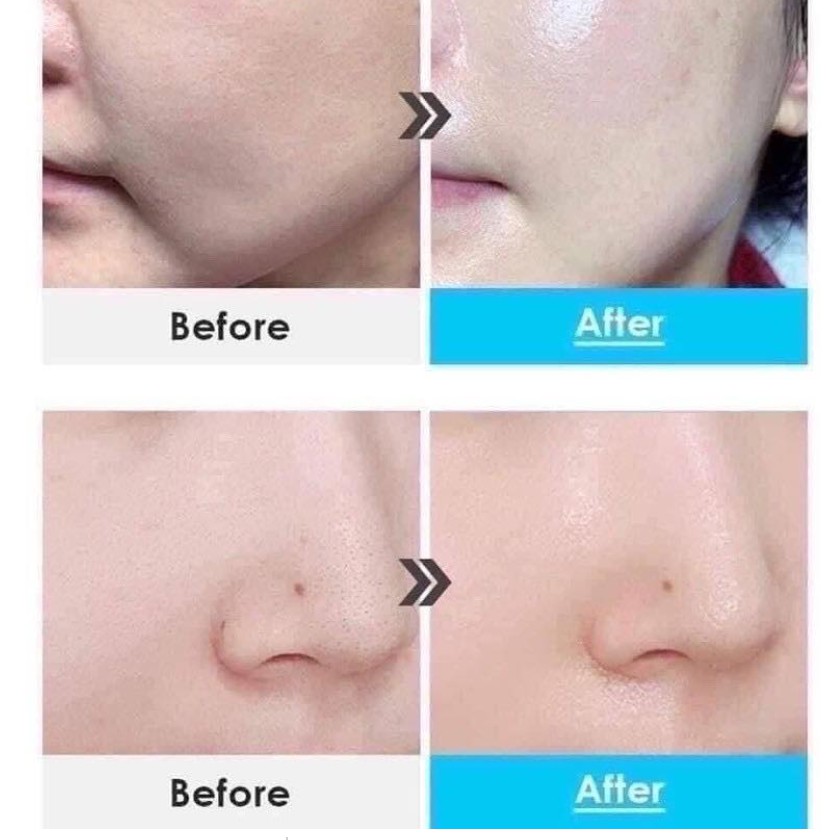 MEDI-PEEL H8 Power Aqua Cream [8 types of Hyaluronic Acid] 50 ml.