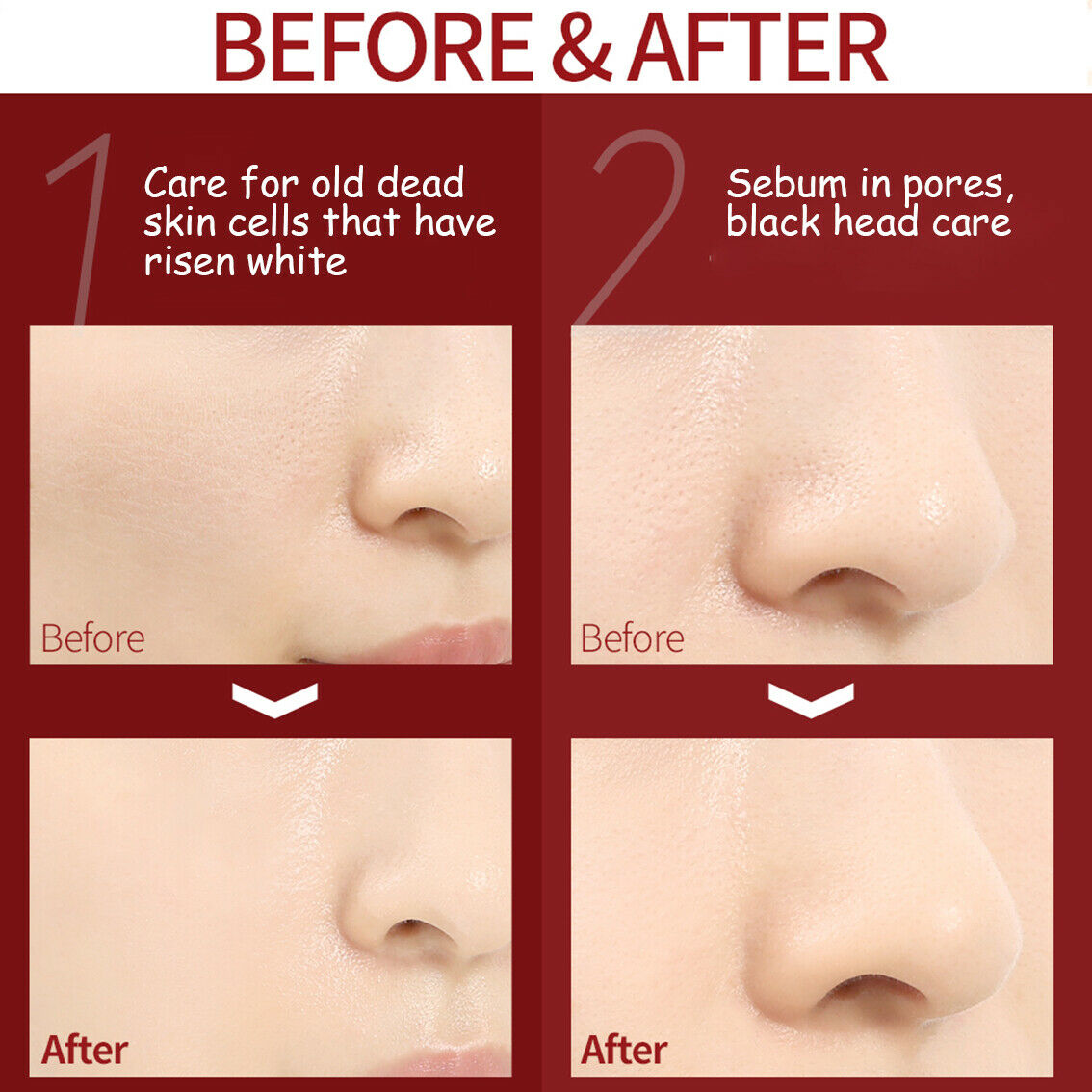 SO Natural Red Peel Tingle Serum Premium Texture 20 ml.