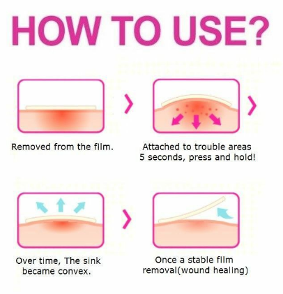 Olive Young Care Plus Scar Cover Spot Patch แผ่นแปะสิว 102 ชิ้น (ซองสีฟ้า)