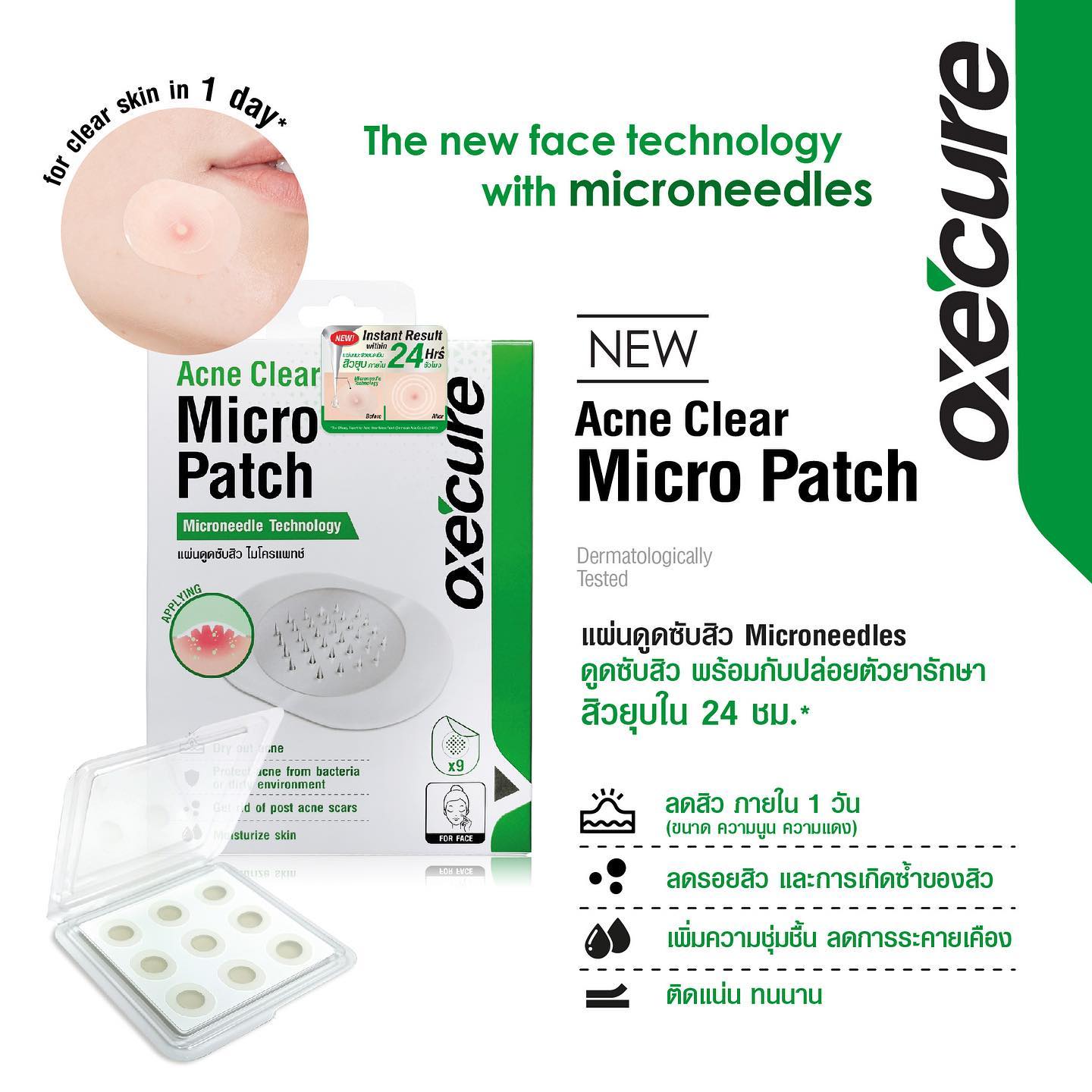 Oxecure Acne Clear Micro Patch 9 ชิ้น