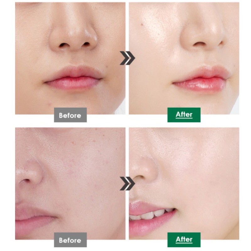 MEDI-PEEL All In One Essence Peptide 9 Volume White Cica Essence 100 ml.