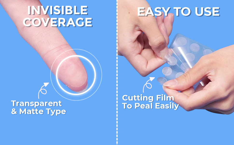 Olive Young Care Plus Spot Patch Big 81 ชิ้น #สีน้ำเงิน