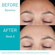 CeraVe Resurfacing Retinol Serum 30 ml.