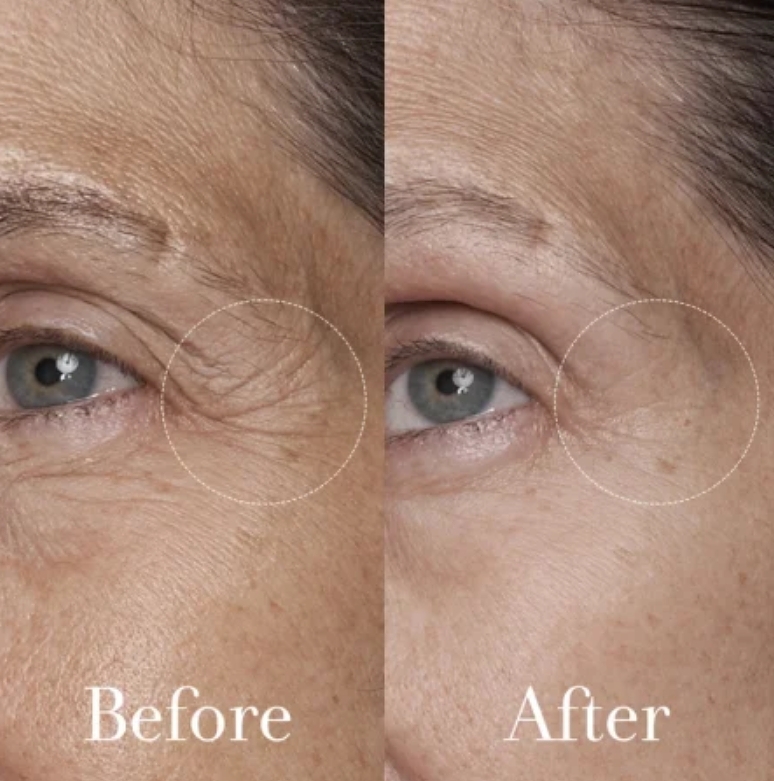 Fresh Black Tea Advanced Age Renewal Cream 50 ml.