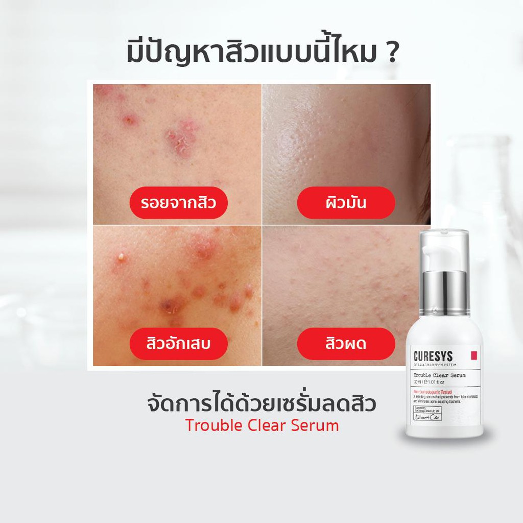 Curesys Trouble Clear Serum 30 ml.