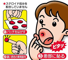 Konai-en Patch Taisho A 10 ชิ้น แผ่นแปะแก้ร้อนในในปาก