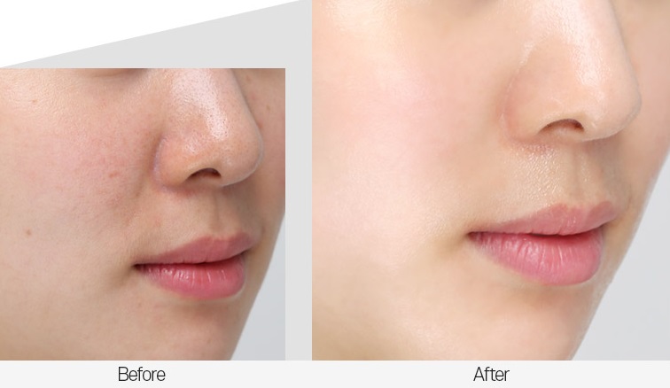 MEDI-PEEL Peptide 9 Volume Essence All in One 100 ml.