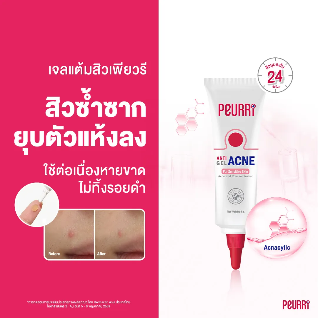 Peurri Anti Acne Gel 8 g.