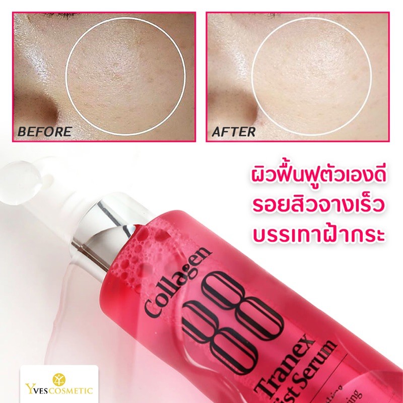 MEDIPICKME Collagen 88 Tranex Mist Serum 100 g.
