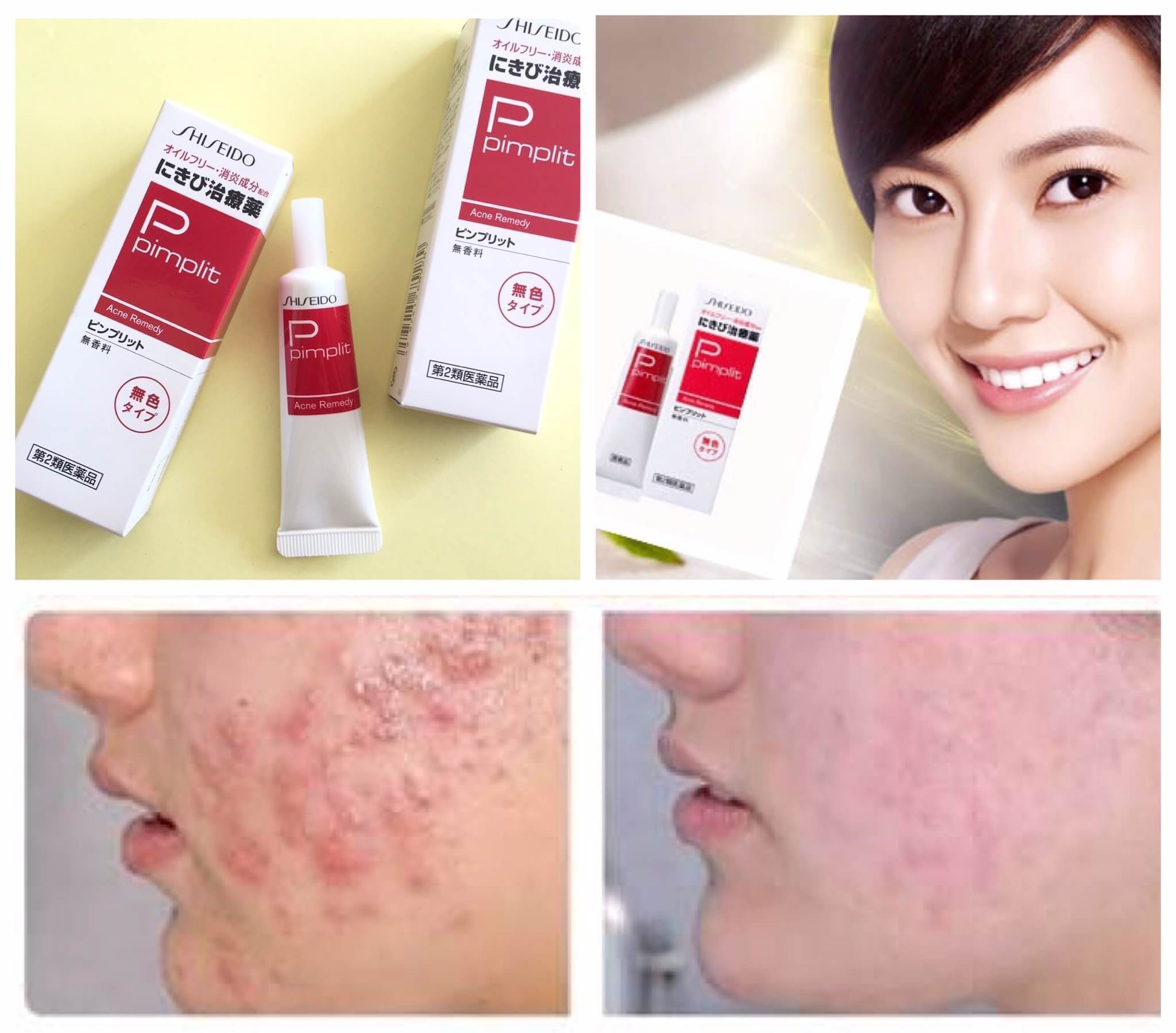 Shiseido Pimplit Acne Remedy 15 g.