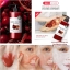 Wonder Bath Super Vegitoks Cleanser 300 ml. #Red สำหรับผิวมีปัญหาจุดด่างดำ ฝ้า กระ