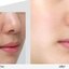 MEDI-PEEL Peptide 9 Volume Essence All in One 100 ml.